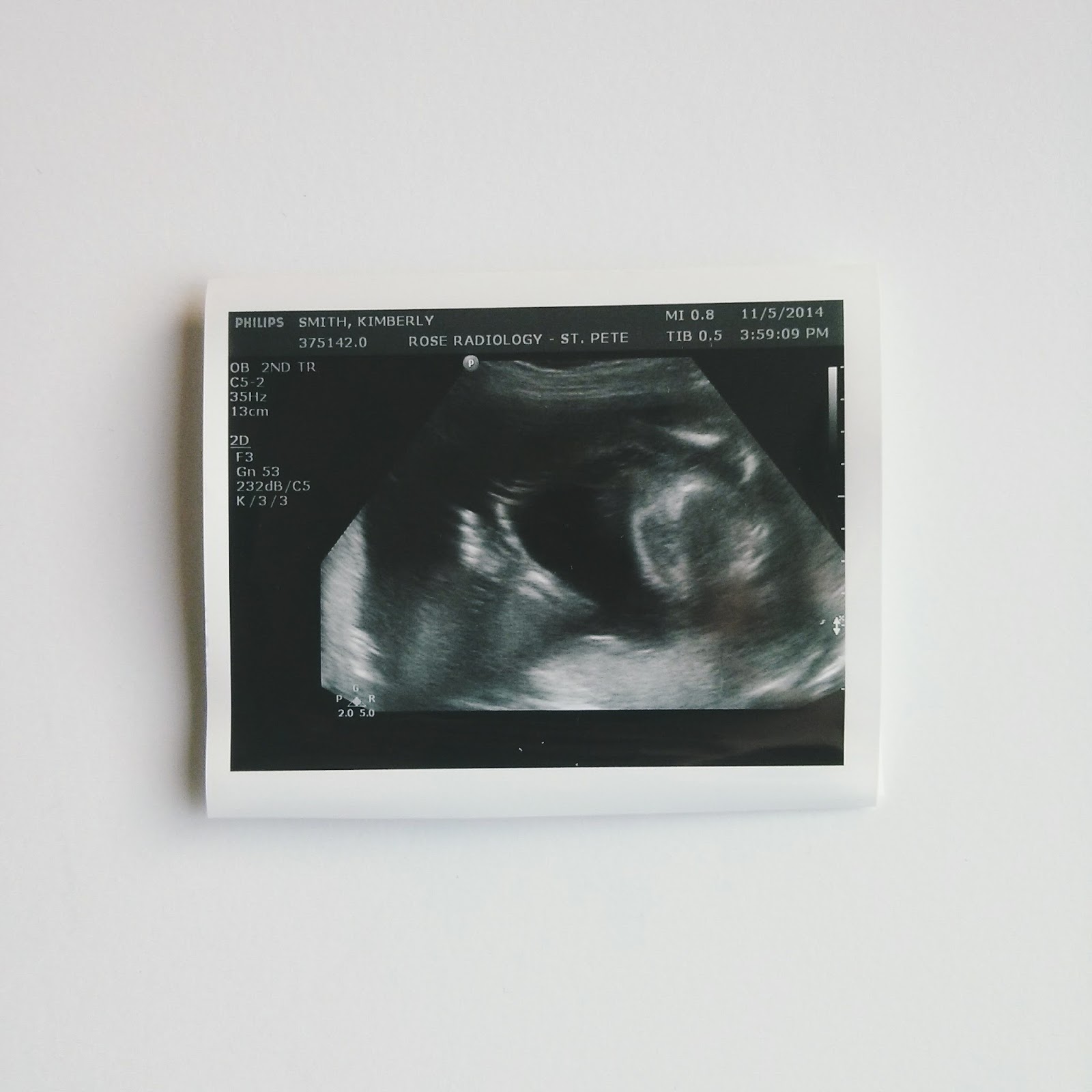 ultrasound thumbs up